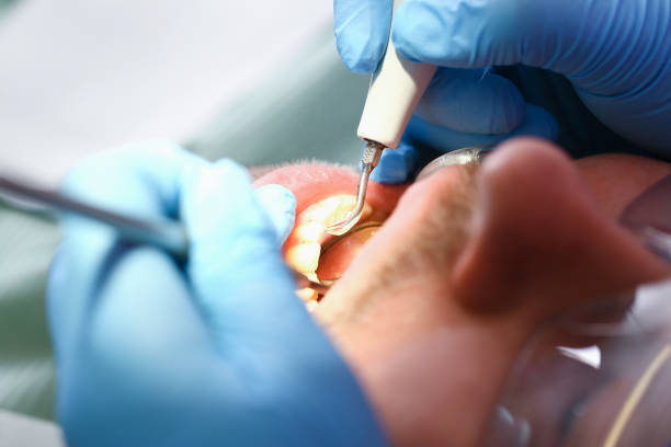 Best Pediatric Emergency Dentist in Natalbany, LA