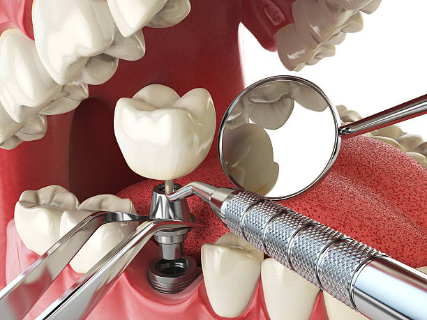 Best Emergency Dental Care for Trauma or Injury in Natalbany, LA