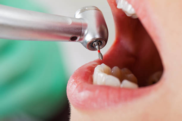 Best After-Hours Emergency Dentist in Natalbany, LA